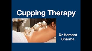 Session 1 Introduction of Cupping Therapy from Myofascial Cupping Therapy Course [upl. by Seedman]