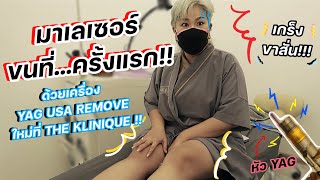 รีวิวเลเซอร์ขนครั้งแรก ด้วยเครื่อง YAG รุ่นใหม่ที่ The Klinique จะรอดหรือร้องงงงงง  Baroctar [upl. by Auqinet]