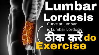 What is the fastest way to fix lumbar lordosisloss of lumbar lordosis exerciselordosislumbarspine [upl. by Anirav]