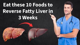 Eat these 10 Foods to Reverse Fatty Liver in 3 Weeks  Fatty Liver Treatment [upl. by Maiga]