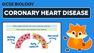 Coronary Heart Disease  GCSE Biology [upl. by Amocat124]