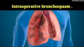 intraoperative bronchospasm [upl. by Trillby400]