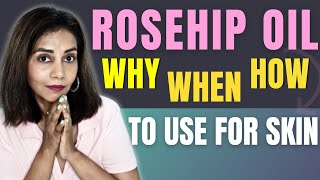 Magic of Rosehip Oil for Your Face How it HELPS amp Tips for Perfect Use [upl. by Nuhs911]