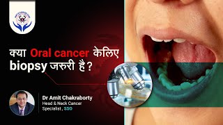 क्या Oral cancer केलिए biopsy जरुरी है  Muh Ke Cancer Ka Test  Dr Amit Chakraborty Mumbai [upl. by Ellon]