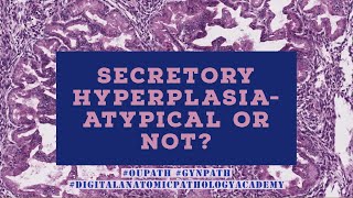 Secretory Hyperplasia Atypical or Not [upl. by Acinhoj944]