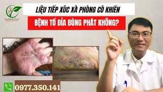 Liệu Tiếp Xúc Xà Phòng Có Khiến Bệnh Tổ Đỉa Bùng Phát Không [upl. by Abbye327]