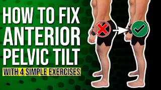 Anterior Pelvic Correction Exercises  The 4 BEST Ones You Can Do [upl. by Cheryl]