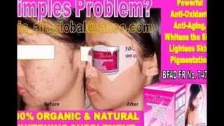 order perfect white aim global cebu philippines  09225347857 [upl. by Gian]