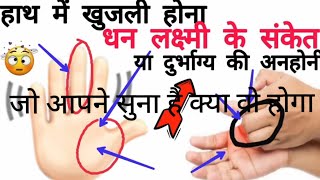 baye hath me khujli बाई हथेली पर खुजली left hand me khujli for female left hand itching [upl. by Lottie318]