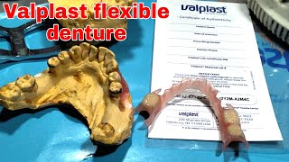 Flexible Dentures Philippines Valplast Brand made in USA New Ace Acrylic Teeth [upl. by Alanson]