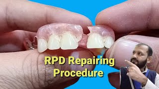 Removable partial denture repairing How to repair a broken partial dentur  Dental Art by Haider [upl. by Nolek551]