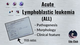 ALL Acute Lymphoblastic LeukemiaLymphoma  Disorders of White Cells  Lymphoid neoplasm Pathology [upl. by Annelise]