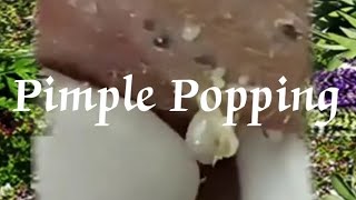 Pimple amp Blackheads Popping  24 [upl. by Beniamino968]