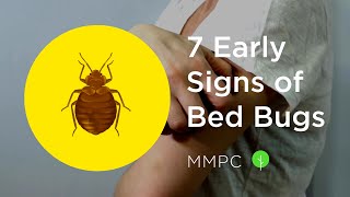 7 Early Signs of BED BUGS How to Know if You Have Bed Bugs [upl. by Ydal179]