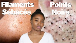 POINTS NOIRS et FILAMENTS SÉBACÉS c est quoi la DIFFERENCE [upl. by Yentterb]