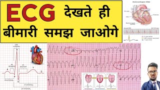 ECG Report  ECG Report Reading  ECG Report kaise Pade  Doctor  Hospital  Nursing  BHMS  BAMS [upl. by Damian]