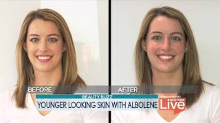 New York Live Beauty Secret with Albolene [upl. by Eisaj38]