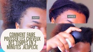 Comment faire pousser les cheveux des tempes en 2 minutes [upl. by Einad695]