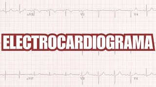 ¿COMO REALIZAR UN ELECTROCARDIOGRAMA  Pt 1 [upl. by Omocaig50]