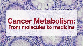 Cancer Metabolism From molecules to medicine [upl. by Retniw]