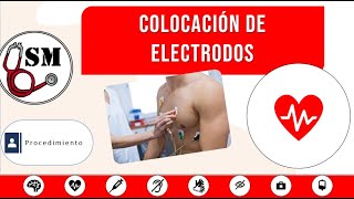 Colocación de electrodos electrodos mono polares bipolares caras del corazon【Simula en Med】 EKG [upl. by Hogan]