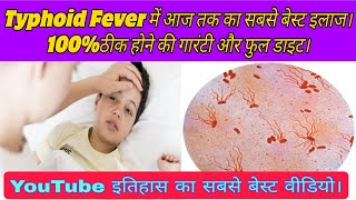 Typhoid fever causessymptomstestdiet and full treatment मोतीझरा का इलाजलक्षण कारणजांचे परहेज। [upl. by Alexandros]