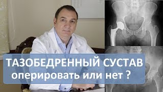 Операция тазобедренного сустава делать или нет Эндопротезирование [upl. by Teerpnam]