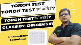 TORCH TEST  Torch Test क्या है  Torch Test क्यो करते हैं Torch Test कैसे करते हैं [upl. by Anderer]