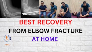 Rehabilitation amp Exercises For Elbow Fracture Recovery  Exercises For Elbow Stiffness Urdu Hindi [upl. by Eugeniusz]