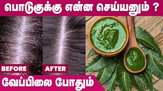 பொடுகை சரி செய்ய வீட்டு வைத்தியம்  Dandruff Treatment at Home in Tamil  IBC Mangai [upl. by Apfel]