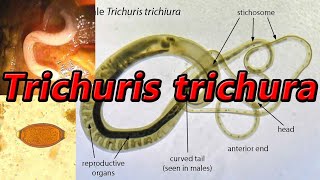 Trichuris trichiura [upl. by Vinay]