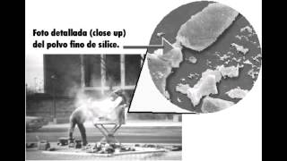 Pneumoconioses  Anthracosis Silicosis amp Asbestosis [upl. by Sean]