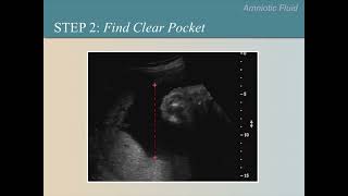 Ultrasound Training Course 10 part 1 [upl. by Daukas]