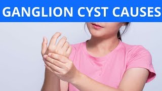 Ganglion Cyst Causes [upl. by Favrot]