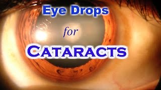 Lanosterol Eye Drops can cure Cataract without Surgery [upl. by Rudwik225]