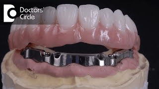 What are Implant Supported Dentures amp for how long do they last  Dr Manesh Chandra Sharma [upl. by Daukas]