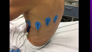 EKG Izquierdo derecho y posterior [upl. by Foley]