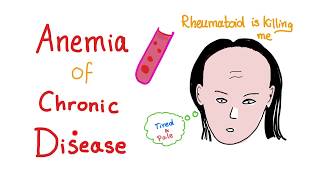 Anemia of Chronic Disease  Anemia of Inflammation All you need to know  Hematology Series [upl. by Thoer]