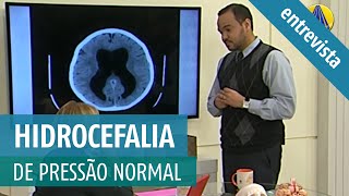 Qual o tratamento para hidrocefalia de pressão normal Quais os sintomas de hidrocefalia crônica [upl. by Nelson]