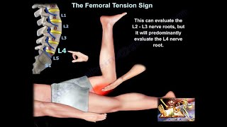 Femoral Tension Sign  Everything You Need To Know  Dr Nabil Ebraheim [upl. by Clava]