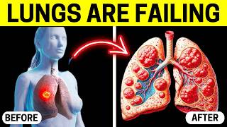 7 Signs Youve Had a Lung Infection Without Knowing [upl. by Ynnaffit399]