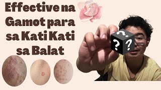 Paano mawala ang kati sa balat  Gamot sa kati kati sa balat  Antifungal Antibacterial KATIALIS [upl. by Darrow]