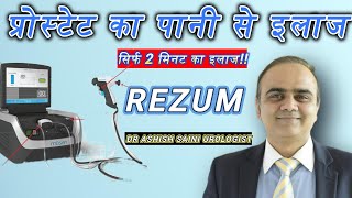 prostate ka paani se ilaj Rezum water vapour therapy [upl. by Rosenblum]