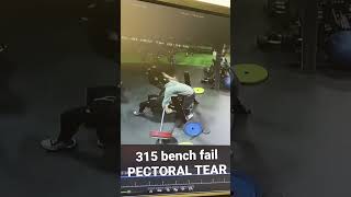 315 bench press FAIL how I tore my pec [upl. by Nerral]