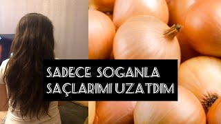 SOÄAN MASKASÄ° EVDE ASAN YOLLA TEZ BÄ°R ZAMANDA SAÃ‡ UZATMA SOÄAN MASKESÄ° HIZLI SAÃ‡ UZATMA [upl. by Arber877]