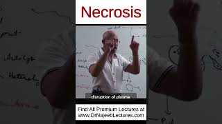 Necrosis drnajeeb drnajeeblectures shortvideo youtubeshorts [upl. by Elke828]