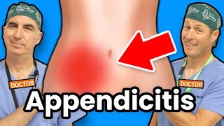 Appendicitis  How Do I Know If I Have Appendicitis [upl. by Ardnuahsal]