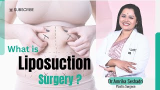 What is Liposuction in plastic surgery By Dr Amrika Seshadri plasticsurgeonskincare [upl. by Yettie938]