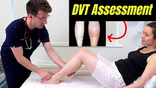 Deep Vein Thrombosis DVT OSCE Clinical Examination  Plus DVT risk factors diagnosis amp treatment [upl. by Wakeen]