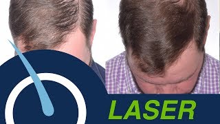 Laser Therapy LLLT  NonSurgical way to Grow your Hair [upl. by Seravat934]